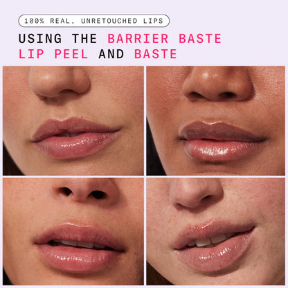 Dr. Idriss | Barrier Baste Lip Basting Duo Exfoliating AHA Lip Treatment + Moisturizing Lip Balm Skincare Gift Set