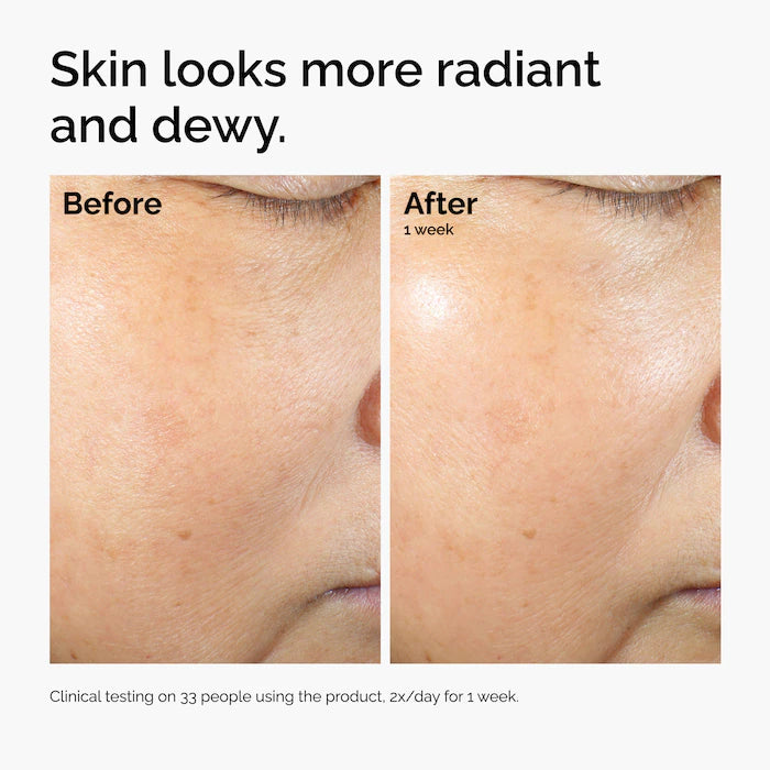 The Ordinary | Rice Lipids + Ectoin Microemulsion Moisturizer for Soothing Hydration & Reduced Redness