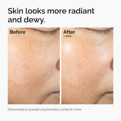 The Ordinary | Rice Lipids + Ectoin Microemulsion Moisturizer for Soothing Hydration & Reduced Redness