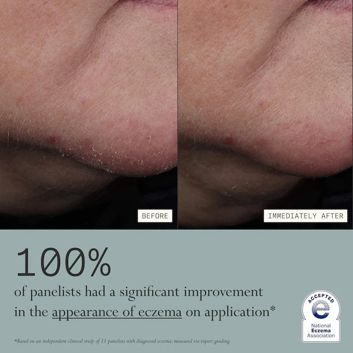 Dieux | Skin Mercy Intense Recovery Cream for Sensitive & Eczema-Prone Skin