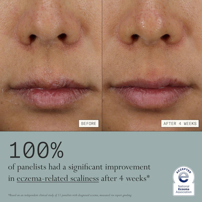 Dieux | Skin Mercy Intense Recovery Cream for Sensitive & Eczema-Prone Skin