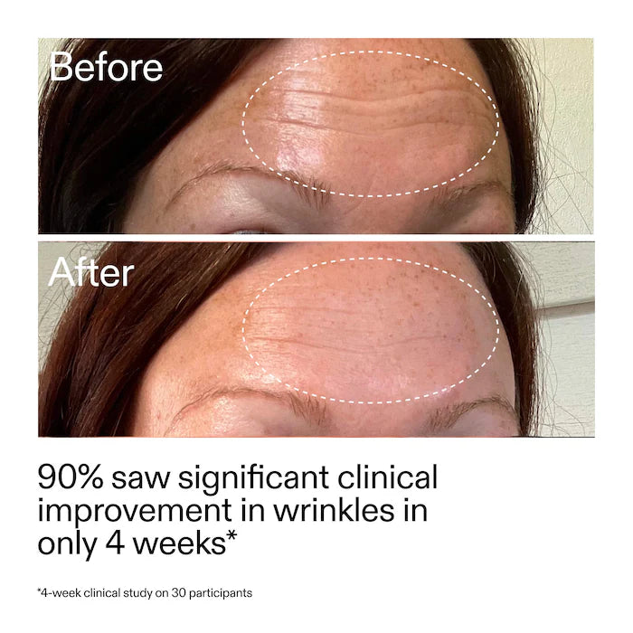 The INKEY List |  Starter Retinol Serum for Fine lines + Wrinkles