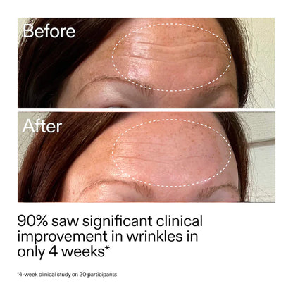 The INKEY List |  Starter Retinol Serum for Fine lines + Wrinkles