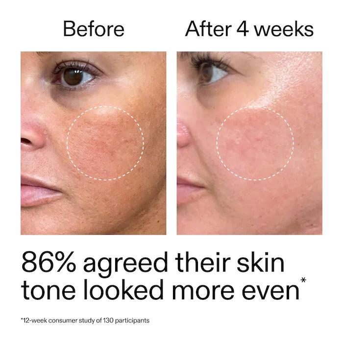 The INKEY List |  Starter Retinol Serum for Fine lines + Wrinkles