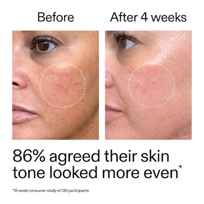 The INKEY List |  Starter Retinol Serum for Fine lines + Wrinkles