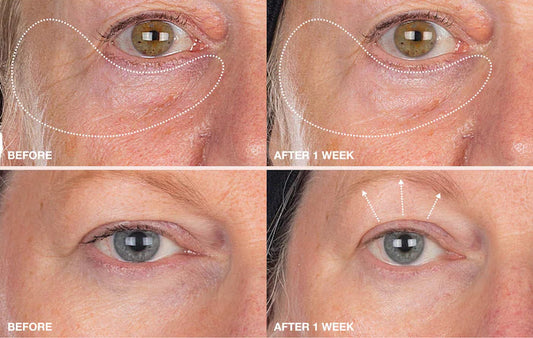 INNBEAUTY Project | Mini Extreme Cream Eye Firming & Contouring Eye Cream