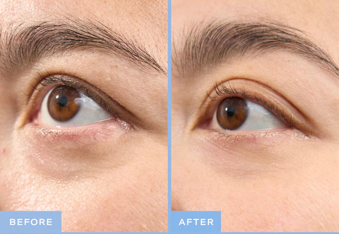 Then I Met You | Snail Mucin Firming and Brightening Eye Cream with Volufiline for Fine Lines & Wrinkles