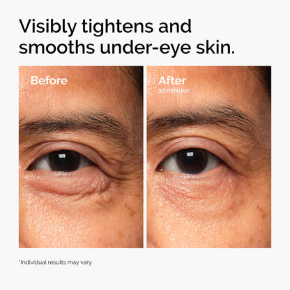 The Ordinary | Lacto-PDRN* 4% + B9 Eye Cream