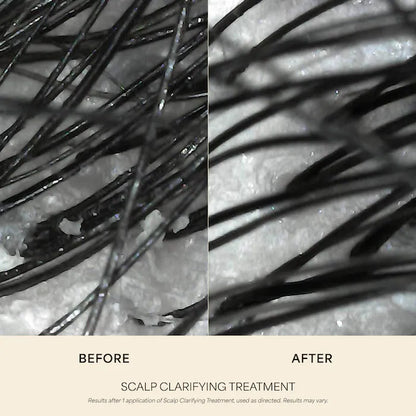 VEGAMOUR | Scalp Clarifying Treatment