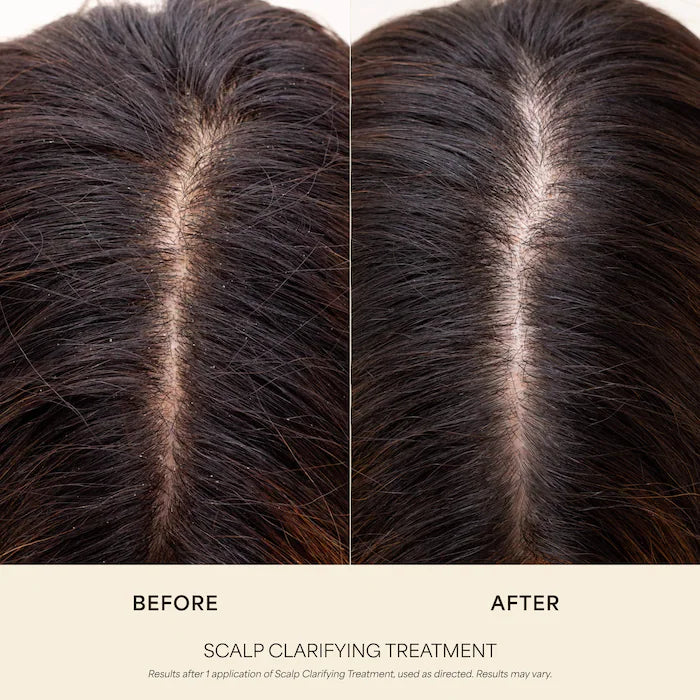 VEGAMOUR | Scalp Clarifying Treatment