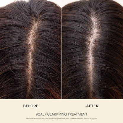 VEGAMOUR | Scalp Clarifying Treatment