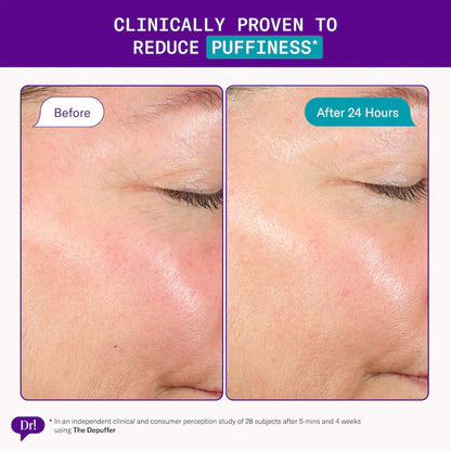 Dr. Idriss | The Depuffer Mini Soothing Roll-On Treatment Serum for Facial Puffiness