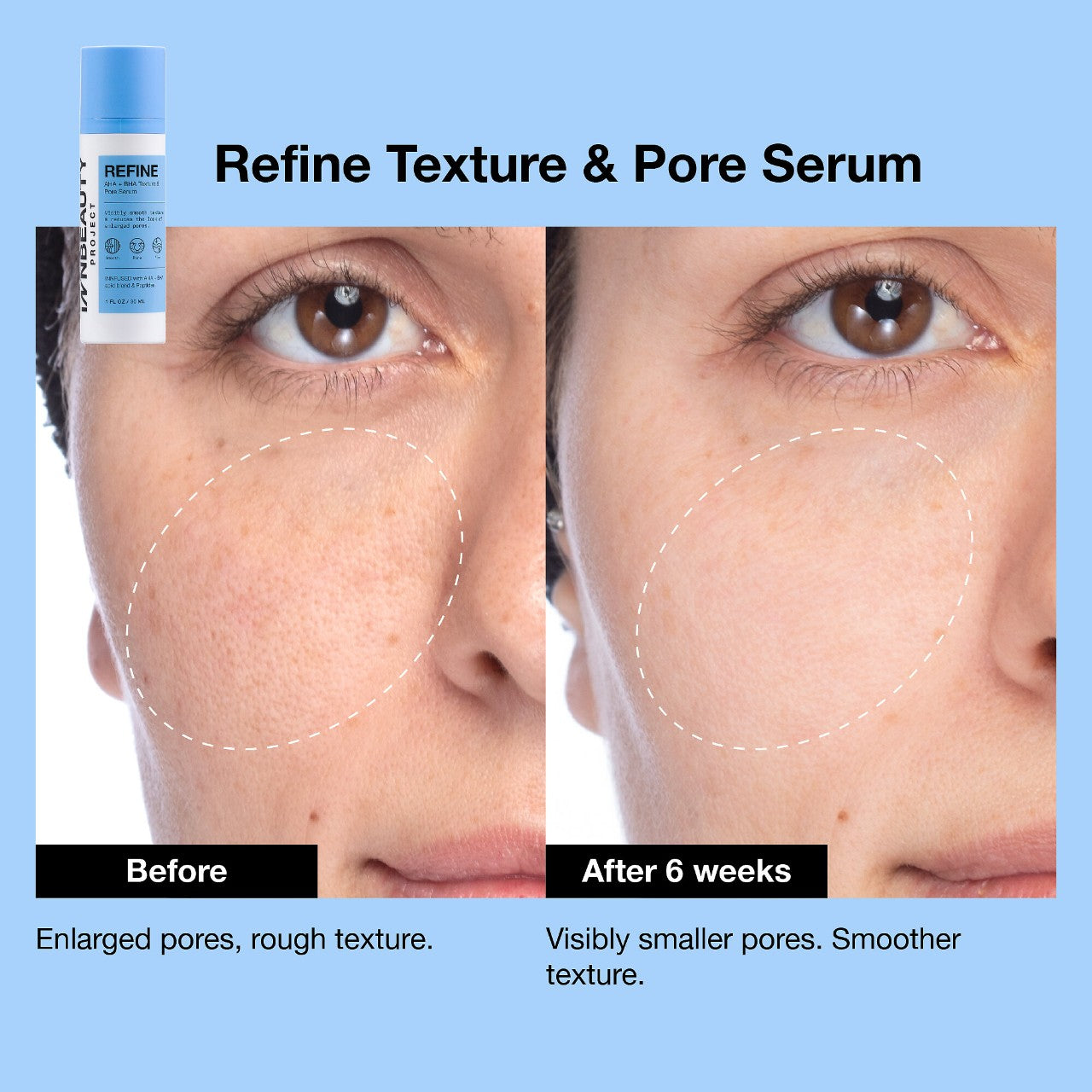 iNNBEAUTY PROJECT | Refine AHA + BHA Texture & Pore Serum